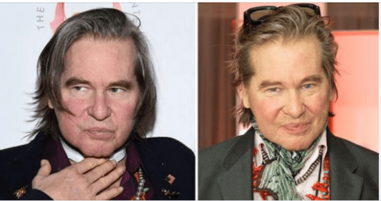 Val Kilmer’s children publish images of themselves, and his son corresponds to him identically.